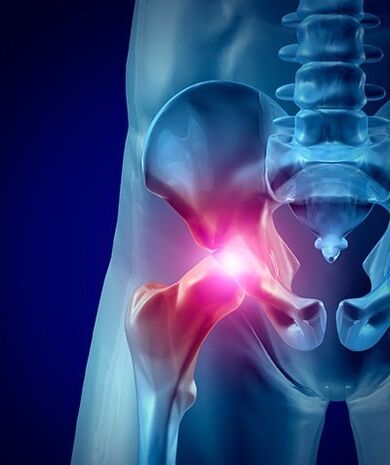 csípőfájdalom fotó 1